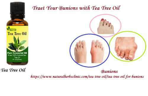 Tea Tree oil for Bunions will all have positive effects and it will help you solve the how to get rid of corns on toes problem once and for all.... https://www.naturalherbsclinic.com/tea-tree-oil/tea-tree-oil-for-bunions