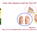 Tea-Tree-Oil-for-Bunions---Natural-Essential-Oils---Natural-Herbs-Clinic