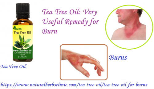 Tea Tree oil for Burns is good because its anti inflammatory properties of tea tree oil can be provide immediate relief for the burns and can be even assist for preventing blistering.... https://www.naturalherbsclinic.com/tea-tree-oil/tea-tree-oil-for-burns