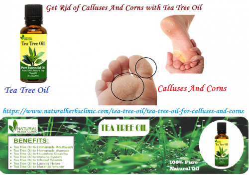 Tea Tree oil for Calluses and Corns is good but See a doctor if your callus is red, hot, bleeding or cracking. These symptoms could indicate an infection.... https://www.naturalherbsclinic.com/tea-tree-oil/tea-tree-oil-for-calluses-and-corns