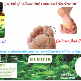 Tea-Tree-Oil-for-Calluses-and-Corns---Natural-Essential-Oils---Natural-Herbs-Clinic