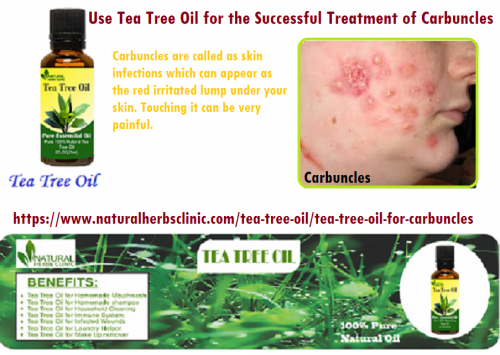 Tea Tree oil for Carbuncles which is a type of natural astringent that is particularly strong. To use tea tree oil to clear up these lesions.... https://www.naturalherbsclinic.com/tea-tree-oil/tea-tree-oil-for-carbuncles