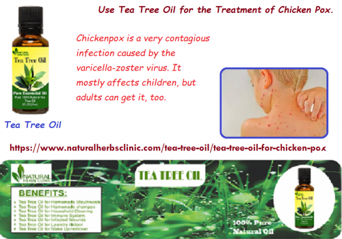 Tea Tree oil for Chicken Pox which is used to aid and treat all kind of health problems and it is often added to home remedies for kill viruses, fungi and bacteria.... https://www.naturalherbsclinic.com/tea-tree-oil/tea-tree-oil-for-chicken-pox