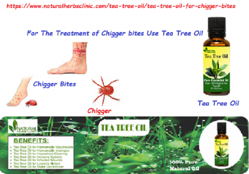 Tea Tree oil for Chigger Bites have the natural compounds in the tea tree oil which cancel out the enzymes used by chiggers to break down the human skin.... https://www.naturalherbsclinic.com/tea-tree-oil/tea-tree-oil-for-chigger-bites