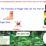 Tea-Tree-Oil-for-Chigger-Bites---Natural-Essential-Oils---Natural-Herbs-Clinic