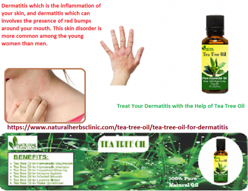 Tea Tree oil for Dermatitis is exactly what your skin needs in its fight against dermatitis. Feel free to give a try because it has no side effects.... https://www.naturalherbsclinic.com/tea-tree-oil/tea-tree-oil-for-dermatitis