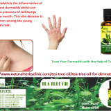 Tea-Tree-Oil-for-Dermatitis---Natural-Essential-Oils---Natural-Herbs-Clinic