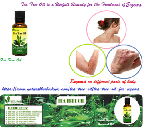 Tea Tree Oil for Eczema can give you relief and apply tea tree oil patches two to three times per day. Soak it in the bath treatment for one to three times per week.... https://www.naturalherbsclinic.com/tea-tree-oil/tea-tree-oil-for-eczema