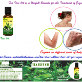 Tea-Tree-Oil-for-Eczema---Natural-Essential-Oils---Natural-Herbs-Clinic