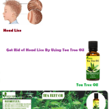 Tea-Tree-Oil-for-Head-Lice---Natural-Essential-Oils---Natural-Herbs-Clinic