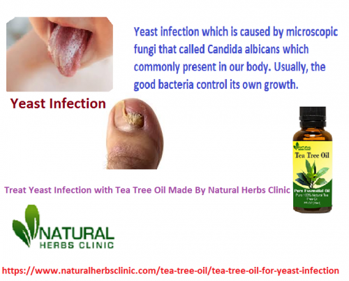 Tea Tree oil for Yeast Infection which contains terpinen – 4 – ol, kills the fungus that causes yeast infections.... https://www.naturalherbsclinic.com/tea-tree-oil/tea-tree-oil-for-yeast-infection