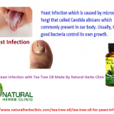 Tea-Tree-Oil-for-Yeast-Infection---Natural-Essential-Oils---Natural-Herbs-Clinic