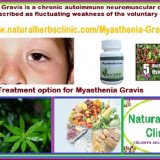 Treatment-for-Myasthenia-Gravis