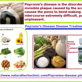 Treatment-for-Peyronies-Disease
