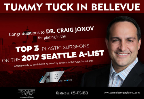 Tummy-Tuck-in-Bellevue.jpg