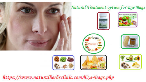 If the eyes have any of the problems like dark circle and eye bags this could be very bad as well as health and beauty purposes. The Under Eye Bags is a very common problem which is affecting most of the people all over the world.... https://naturalcureproducts.wordpress.com/2017/12/14/home-remedies-for-eye-bags-do-they-really-work/
