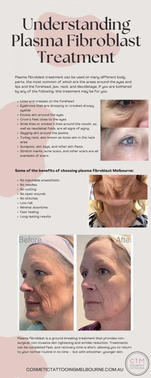 The plasma fibroblast treatment is a high-precision technology that has undergone extensive testing throughout the years. It’s a treatment that uses technology to deliver precise energy to the skin, resulting in better results and faster healing. The plasma fibroblast treatment is also quite adaptable, as it may be used to repair a variety of flaws in various places of the face and body. For more information visit the website https://cosmetictattooingmelbourne.com.au/plasma-fibroblast-therapy/

#plasmafibroblastmelbourne #plasmafibroblasttreatment #CosmeticTattooingMelbourne #cosmetictattooing