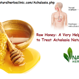 Use-Valuable-Herbal-Aliments-in-Natural-Remedies-for-Achalasia