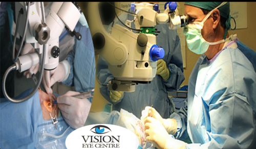 Vitreo-retinal-surgeon-in-Delhi2107cd3dfd2a1556.png