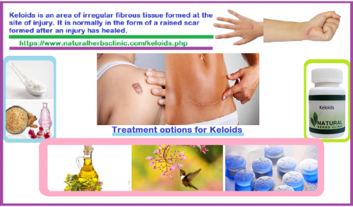 Keloids are light or dark red thickened skin cell tissue. Keloids Look like hypertrophic scars, but they are not the same thing. After your skin is injured, you are generally left with a flat scar.... https://herbalresource.livejournal.com/2640.html