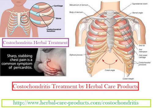 There are also a mixture of herbal remedies used as Costochondritis Natural Treatment that help lessen pain and inflammation of the affected area.
https://herbalcareproductstreatment.wordpress.com/2015/03/11/costochondritis-symptoms-treatment-natural-herbal-product/