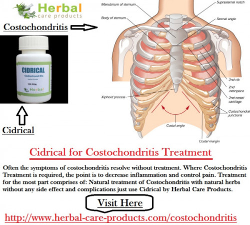 Herbal Treatments for Costochondritis are used to diminish the torment and exacerbation in the impacted domain. Costochondritis Natural Treatment may reduce your costochondritis-related torment and bothering.
Costochondritis Herbal Treatment
https://herbalcareproductstreatment.wordpress.com/2016/10/08/costochondritis-herbal-treatment/