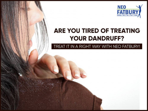 Neo FatBury provides highly effective Anti Dandruff Removal Treatment in Hyderabad. Our Hair experts examine the scalp's skin and help to get Rid of dandruff.
contact as @ 9100939727
visit more info:
http://www.neofatbury.com/anti-dandruff-Treatment