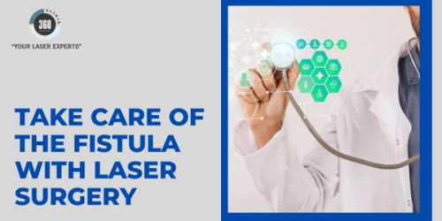 Fistula laser surgery is perfect on all sides. The patients should have this painless surgery that helps them in creating and well as healing faster.
https://laser-clinic-delhi.jimdofree.com/2022/10/23/take-care-of-the-fistula-with-laser-surgery/