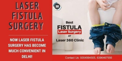 fistula-surgery.jpg