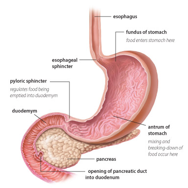 gastroparesis-symptoms.jpg