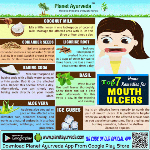 home-remedies-for-mouth-ulcers.jpg