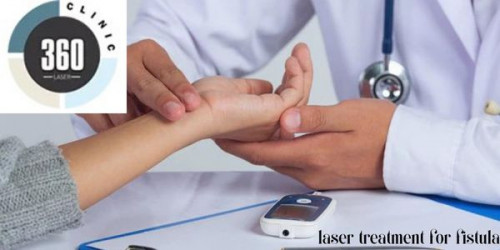 Get laser treatment for Fistula in Delhi and have the perfect level of laser surgeries with the best recovery rate.
https://laser360clinic.com/laser-fistula-treatment/