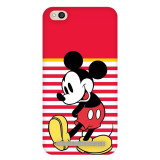 small_0059_318-mickey-ye-ye.psdredmi-5a