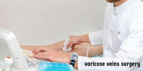 In case your search for the most trusted clinic for Varicose Veins Treatment in NCR failed to make you reach the best laser specialists, then be sure about reaching Laser360Clinic. 
https://laser360clinic.com/laser-varicose-veins-treatment/